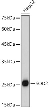 SOD2 Rabbit Antibody