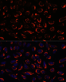 SHMT2 Rabbit Antibody