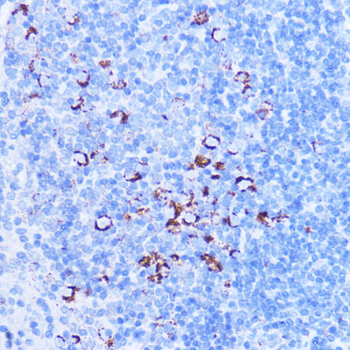 SHMT2 Rabbit Antibody