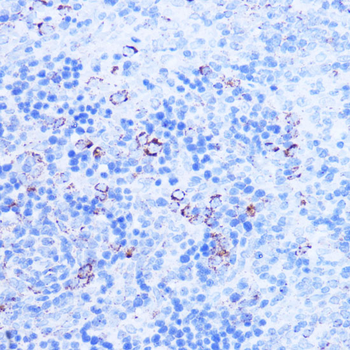 SHMT2 Rabbit Antibody