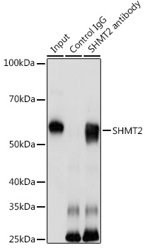 SHMT2 Rabbit Antibody