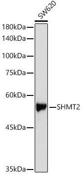 SHMT2 Rabbit Antibody