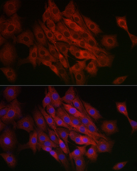 TFEB Rabbit Antibody