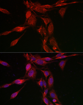 TFEB Rabbit Antibody