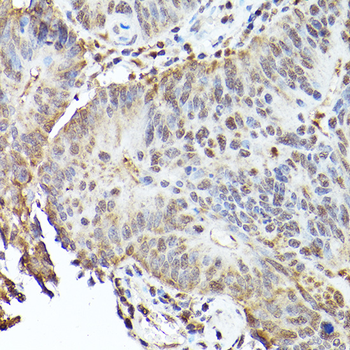 TFEB Rabbit Antibody