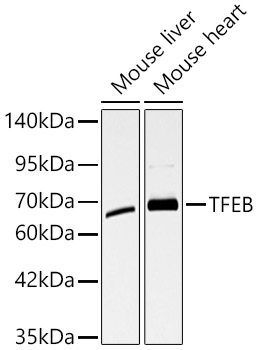 TFEB Rabbit Antibody