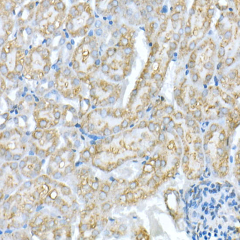 VDAC1 / Porin Rabbit Antibody