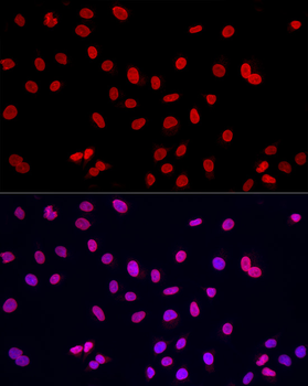 Lamin A/C Rabbit Antibody