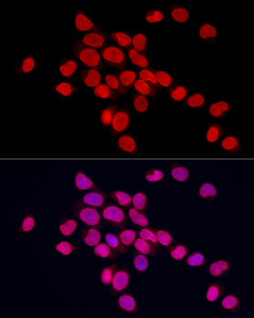 Lamin A/C Rabbit Antibody