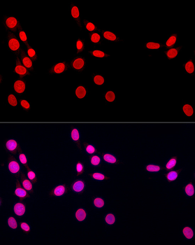 Lamin A/C Rabbit Antibody