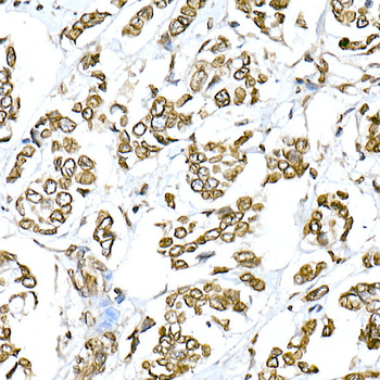 Lamin A/C Rabbit Antibody