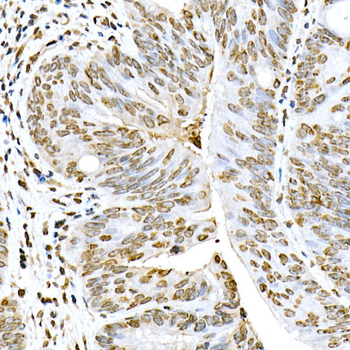 Lamin A/C Rabbit Antibody