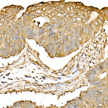 Hsp90β Rabbit Antibody