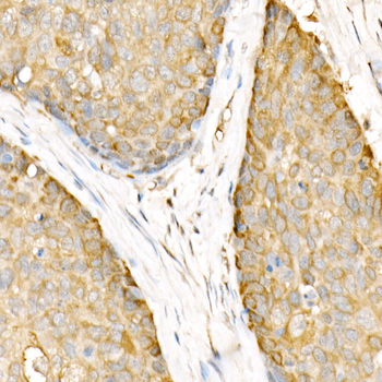 Hsp90β Rabbit Antibody