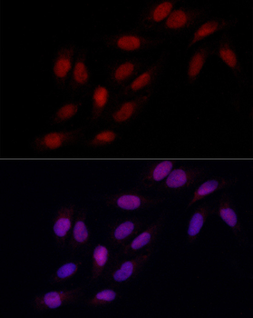 MSH6 Rabbit Antibody