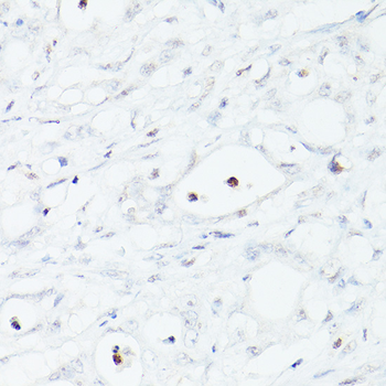 MSH6 Rabbit Antibody