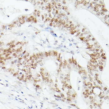 MSH6 Rabbit Antibody