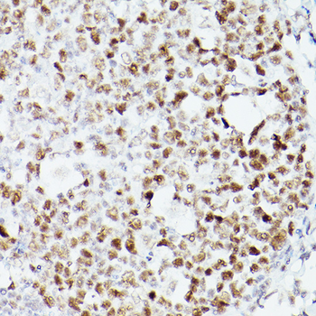 MSH6 Rabbit Antibody