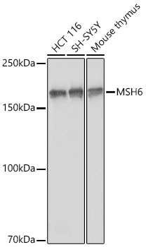 MSH6 Rabbit Antibody