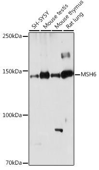 MSH6 Rabbit Antibody