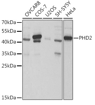 PHD2/EGLN1 Rabbit Antibody