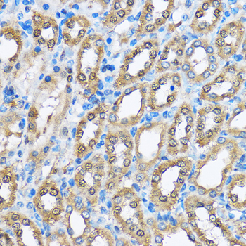 PHD2/EGLN1 Rabbit Antibody