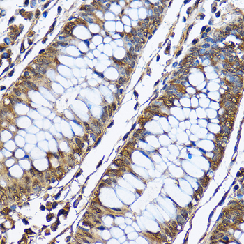 PHD2/EGLN1 Rabbit Antibody