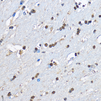 PHD2/EGLN1 Rabbit Antibody