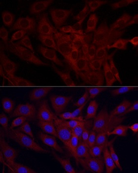 SRP72 Rabbit Antibody