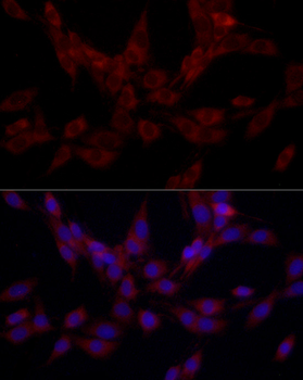 SRP72 Rabbit Antibody