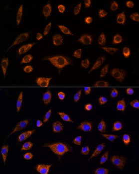 AIF Rabbit Antibody