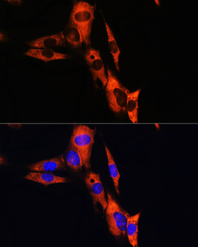 ATP1B1 antibody