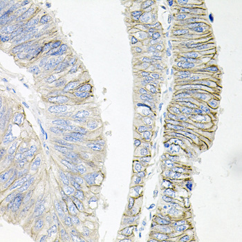 ATP1B1 antibody