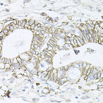 ATP1B1 antibody