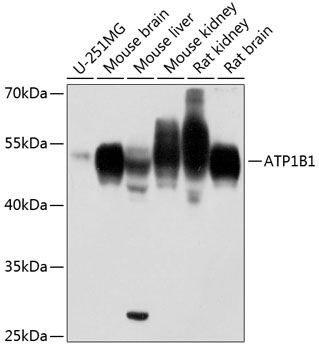 ATP1B1 antibody