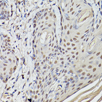 ETV4 antibody