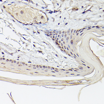 ETV4 antibody