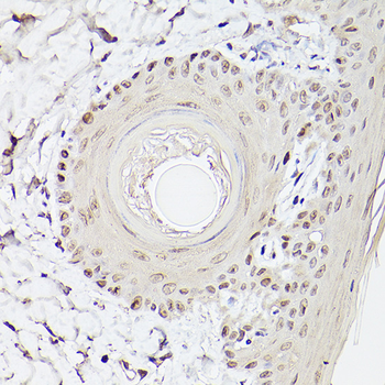 ETV4 antibody