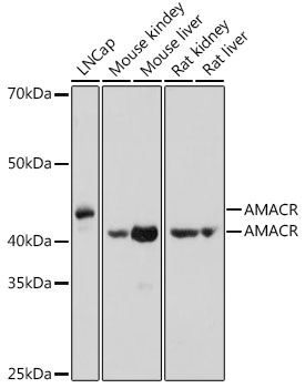 AMACR antibody