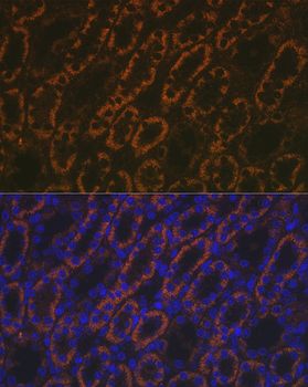 AMACR antibody