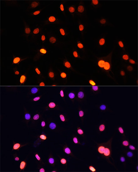 Pan DiMethyl-lysine antibody