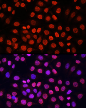 Pan DiMethyl-lysine antibody