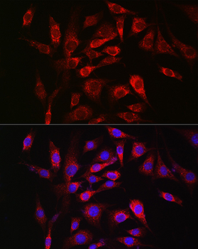 SOCS3 antibody