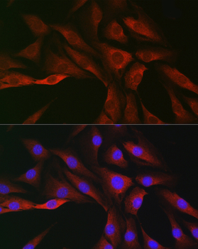 SOCS3 antibody