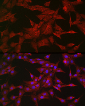 SOCS3 antibody