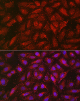 SOCS3 antibody