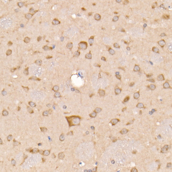 SOCS3 antibody