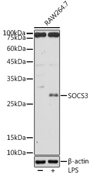 SOCS3 antibody