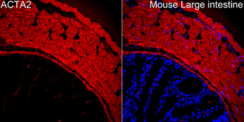 α-Smooth Muscle Actin (ACTA2) Rabbit pAb Antibody