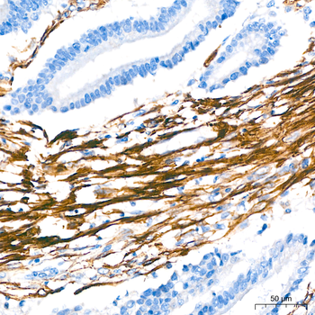 α-Smooth Muscle Actin (ACTA2) Rabbit pAb Antibody